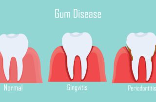 treating gum disease in roslyn heights ny
