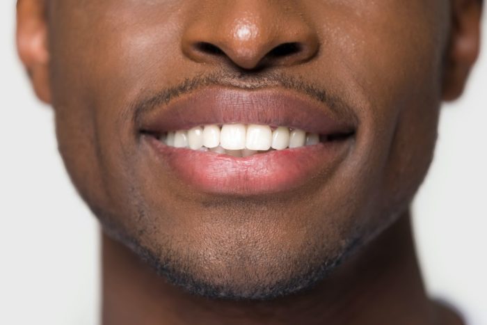 closeup of young man smiling, teeth cleaning, oral health dentist in Roslyn Heights New York