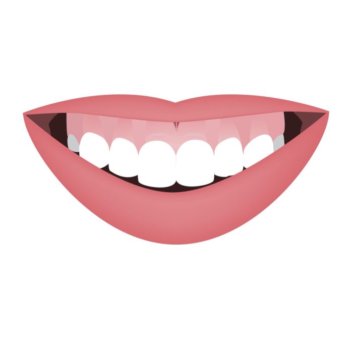 Cartoon image of a bright, white smiling mouth enamel erosion dentist in Roslyn Heights New York