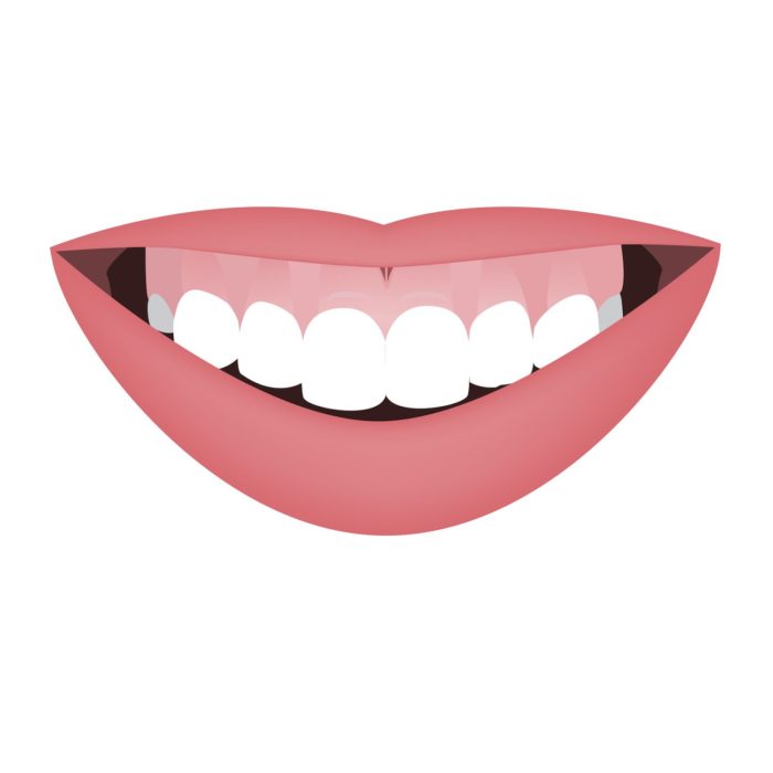 Cartoon image of a bright, white smiling mouth enamel erosion dentist in Roslyn Heights New York