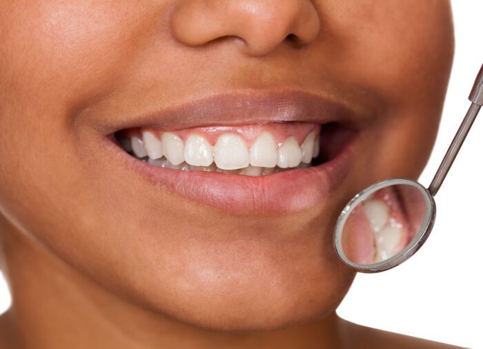 Bleeding Gums in Roslyn Heights NY could indicate gum disease that affects your oral health