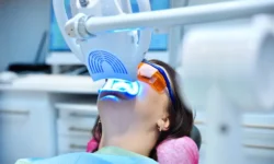 Why Choose Professional Teeth Whitening in Roslyn Heights, NY